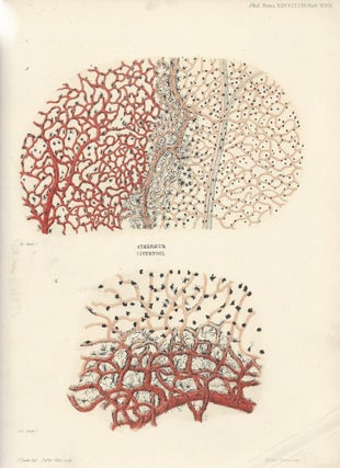 INFLAMMATION: "An Inquiry Regarding the Parts of the Nervous System Which Regulate the Contractions of the Arteries," "On the Cutaneous Pigmentary System of the Frog," & "On the Early Stages of Inflammation" (Philosophical Transactions of the Royal Society of London, Vol. 148 for the Year 1858, pp. 607-625, 627-643, 645-702)
